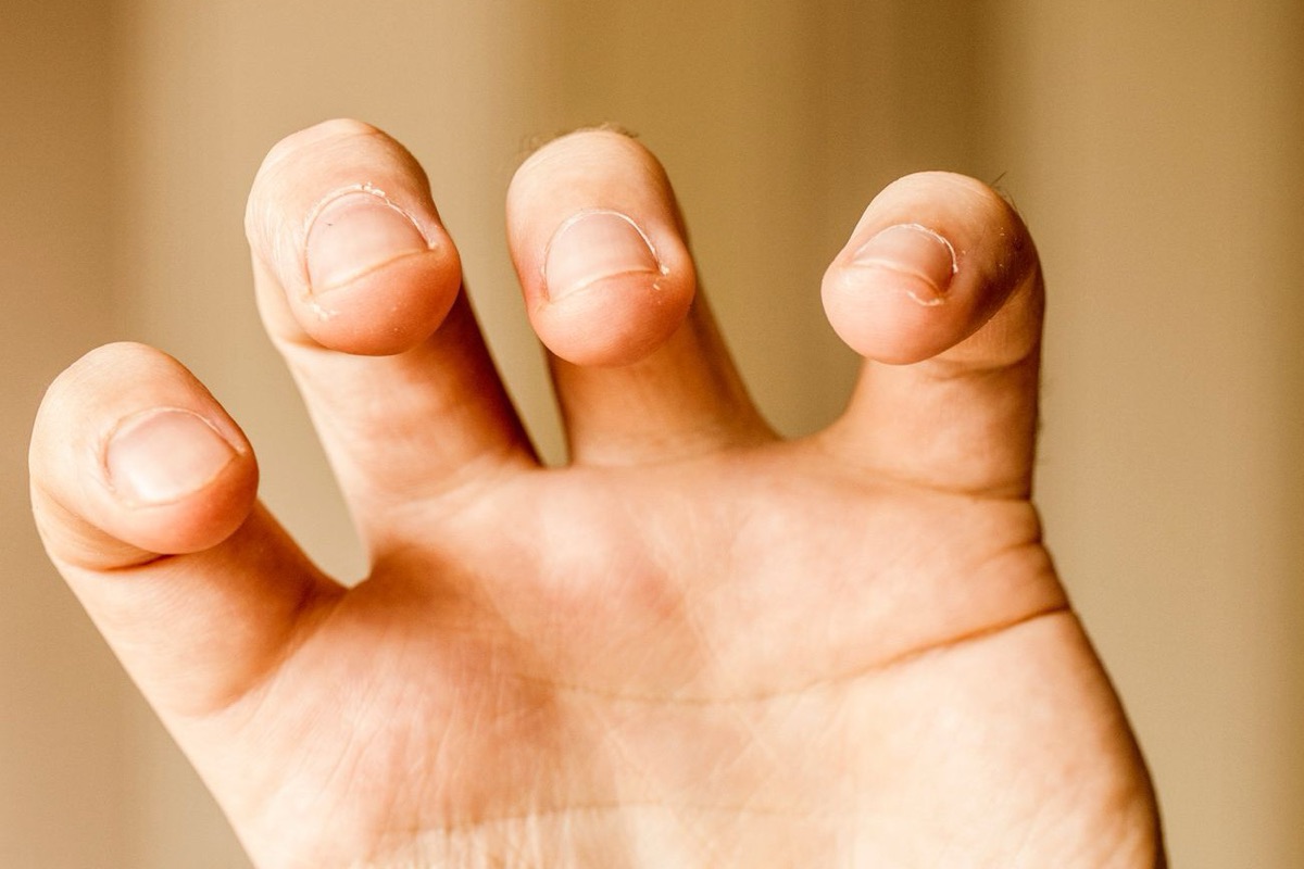 Ongles rongés